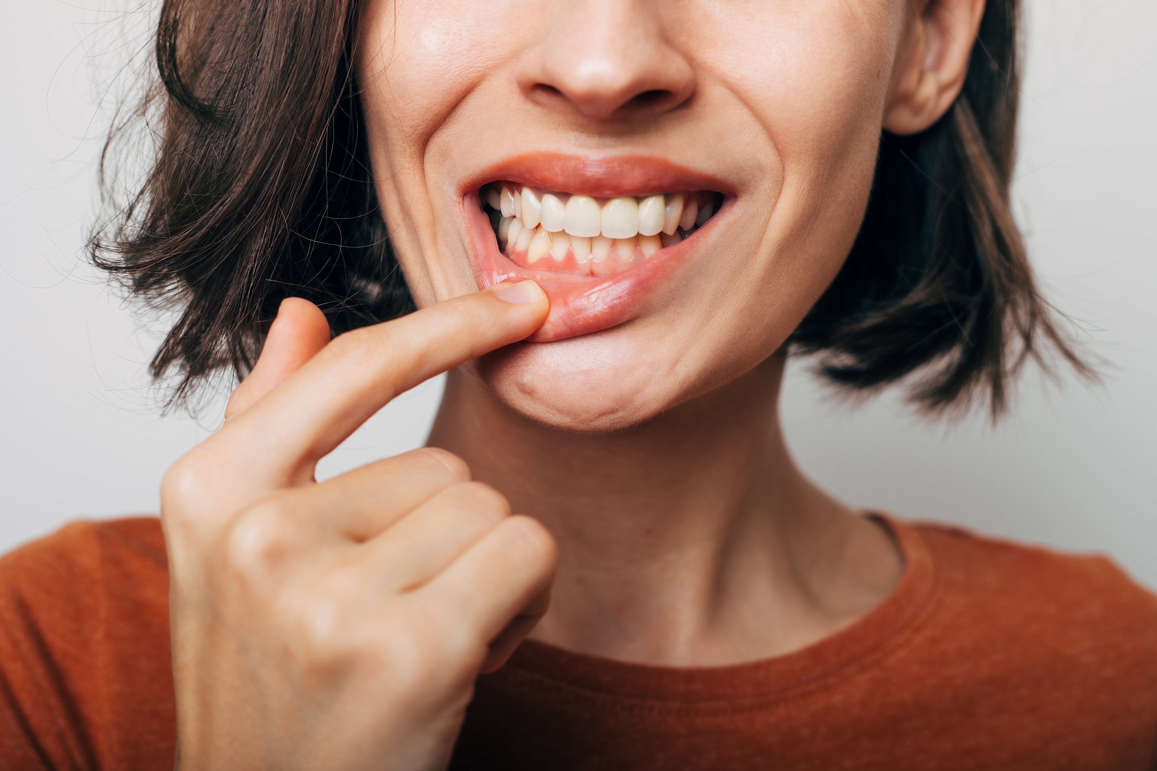 vitamin e for gums